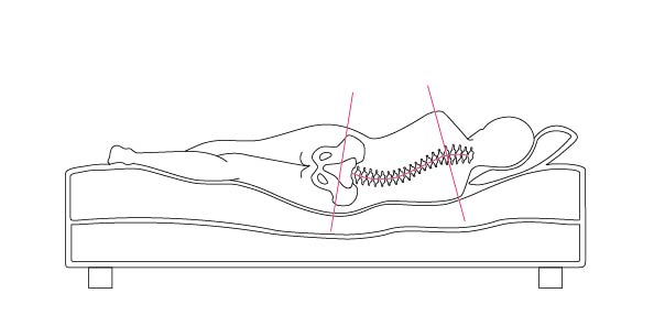 Illustration of a body lying on a soft bed showing a curved spine