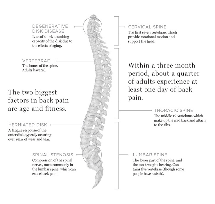 Diagram of the human spine with medical statistics